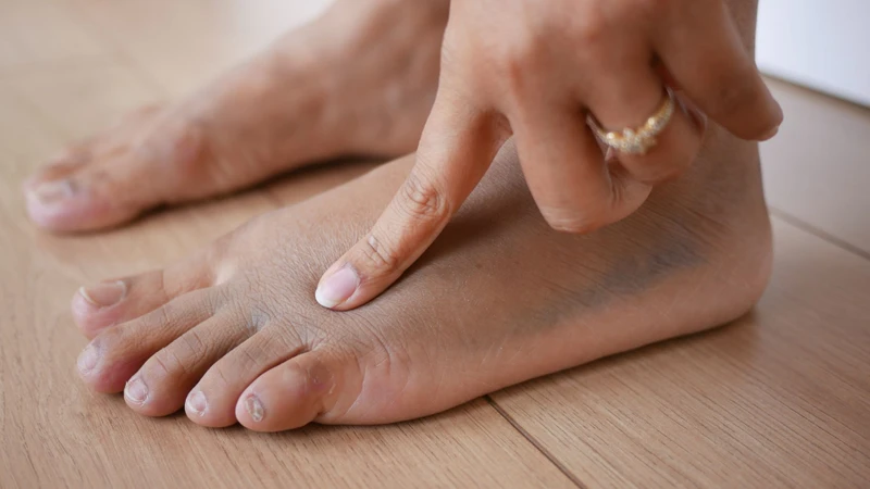 Creatinin trong xét nghiệm máu là gì? Tại sao cần làm xét nghiệm creatinin? 2