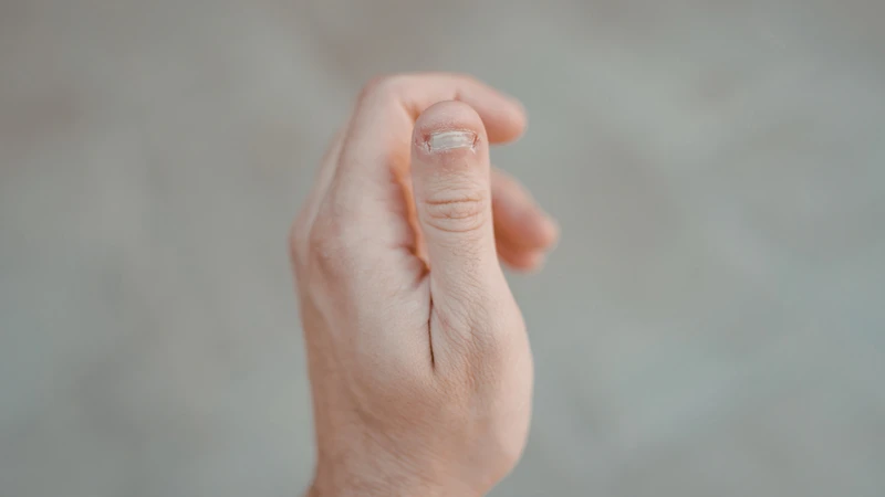 Khớp ngón tay và cơ chế gây cứng khớp ngón tay do viêm màng hoạt dịch