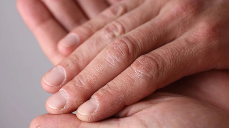 Da nổi mẩn đỏ ngứa do nguyên nhân gì? Mẹo đơn giản giúp giảm mẩn ngứa toàn thân an toàn tại nhà 1
