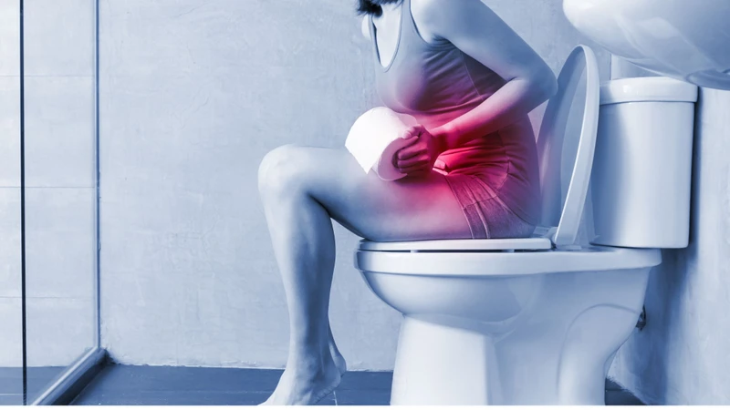 Da thừa hậu môn​ là gì? Triệu chứng nhận biết và cách phòng ngừa 3