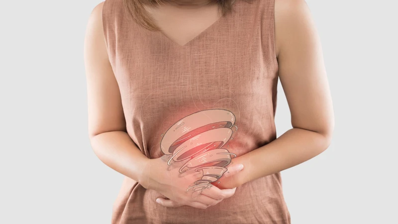 Đại tràng kích thích: Nguyên nhân, triệu chứng và cách điều trị hiệu quả 3