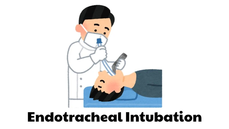 Hầu hết các thủ thuật đặt nội khí quản được thực hiện trong bệnh viện