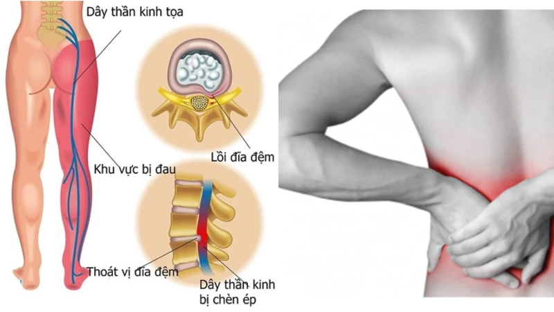dau-cot-song-la-gi-nhung-van-de-can-biet-ve-dau-cot-song3.png