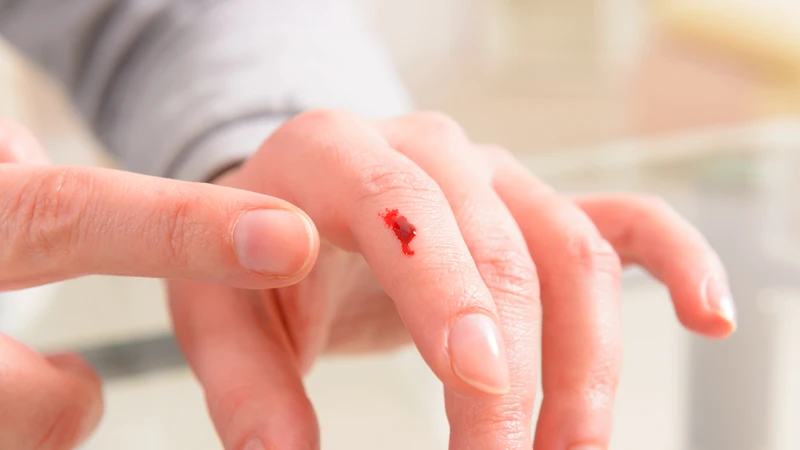 Vết thương lâu lành là một trong những dấu hiệu không nên bỏ qua