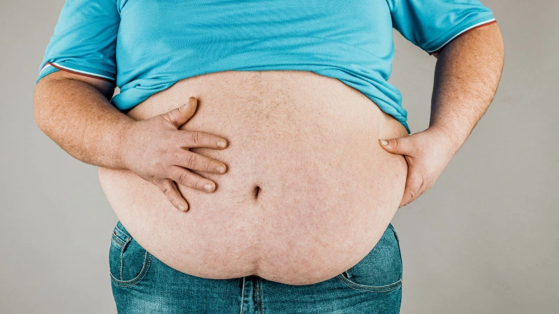 Dấu hiệu béo phì: Cách nhận biết và phòng ngừa 3
