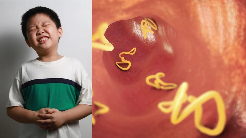 Dấu hiệu bị sán chó và cách phòng bệnh cần nắm 4