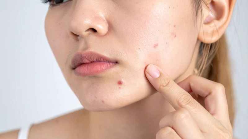 Phân biệt đúng các phản ứng trên da là bước quan trọng trong chăm sóc da