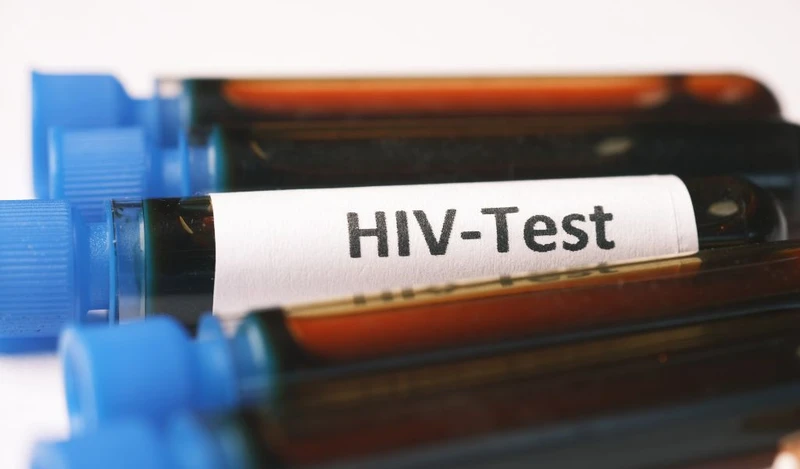 Các dấu hiệu HIV ở nữ giới trong giai đoạn đầu 4