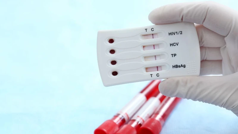 Dấu hiệu HIV và những thông tin liên quan về bệnh cần nắm! 5