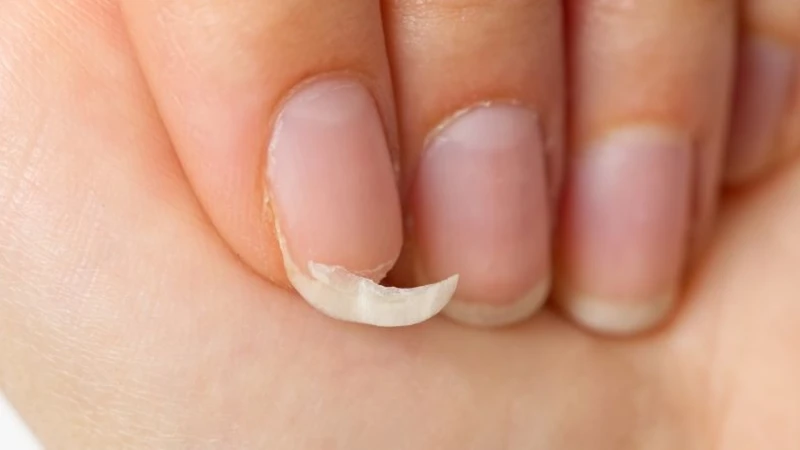 Móng tay giòn yếu, dễ gãy thường xuyên có thể là dấu hiệu cơ thể thiếu hụt biotin cần lưu ý