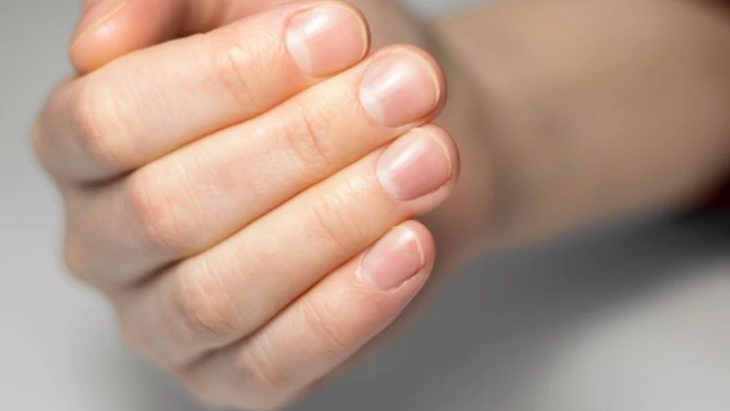 Móng tay khỏe mạnh có màu hồng nhạt tự nhiên, bề mặt nhẵn mịn, hình dáng cong cân đối