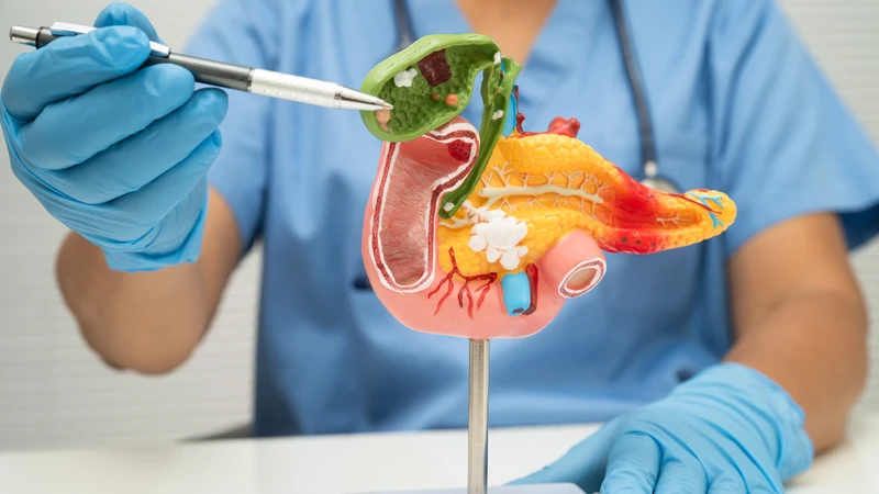 Sỏi mật ở trẻ em không điều trị kịp thời có nguy cơ dẫn đến biến chứng tắc ống mật