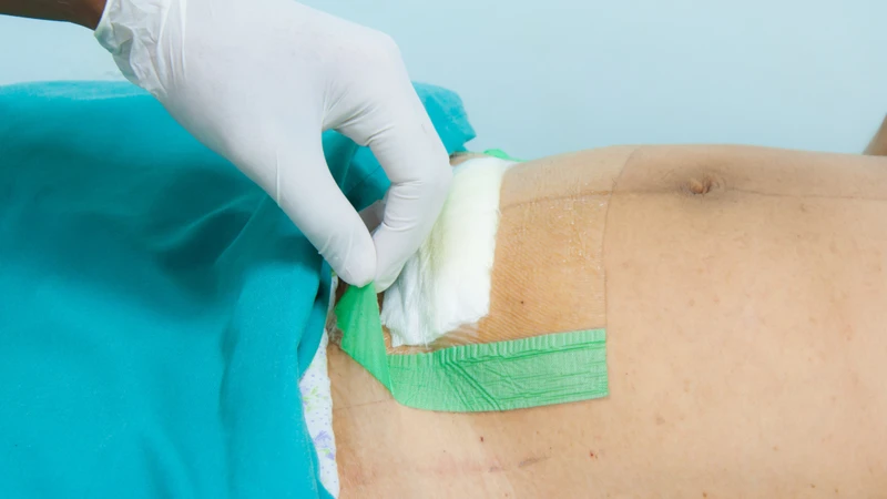 Tình trạng nhiễm trùng bên trong thường khó quan sát bằng mắt thường