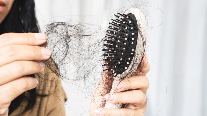 Rụng tóc nhiều bất thường là một dấu hiệu thiếu kẽm