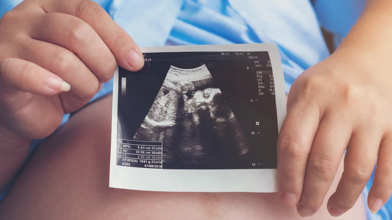 Dấu hiệu tiền sản giật cần được nhận biết sớm để giảm nguy cơ biến chứng cho mẹ và thai nhi