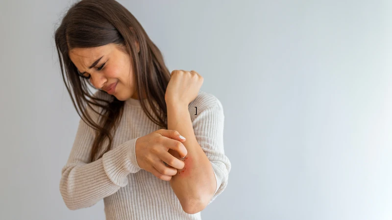 Viêm da cơ địa thường không tự hết hoàn toàn mà có thể tái phát, cần chăm sóc và kiểm soát đúng cách