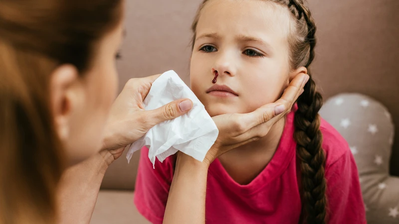 Dấu hiệu xì mũi ra cục máu đông bất thường không nên xem nhẹ 1