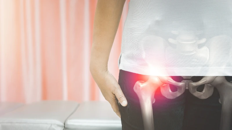 Quá trình lão hóa tự nhiên khiến sụn khớp dần bị bào mòn, giảm khả năng đàn hồi và bôi trơn, làm tăng nguy cơ thoái hóa và đau khớp háng