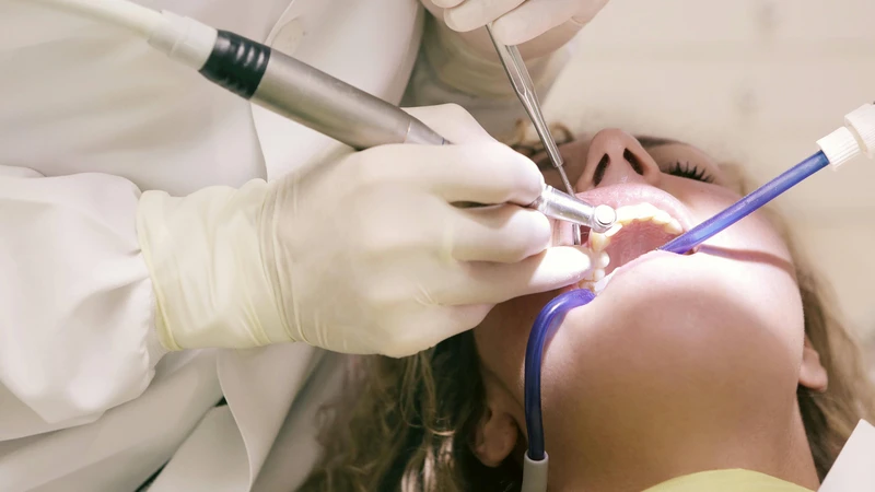 Nếu do sâu răng, bác sĩ sẽ điều trị bằng phương pháp hàn trám hoặc bọc sứ