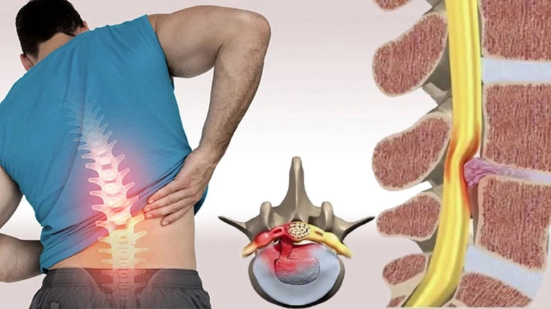 Đau vùng chậu ở nam giới: Nguyên nhân, triệu chứng đi kèm và cách điều trị hiệu quả 2