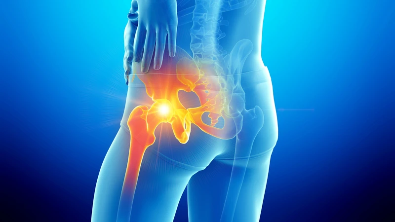 Xác định đúng vị trí đau giúp phân biệt với đau thắt lưng thông thường