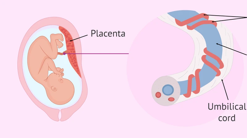 Dây rốn 1 động mạch là tình trạng dây rốn chỉ có 1 động mạch thay vì 2; đa số trường hợp đơn độc vẫn có tiên lượng tốt