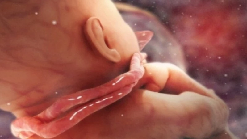 Dây rốn quấn cổ 2 vòng không phải lúc nào cũng nguy hiểm nhưng thường cần được theo dõi thai kỳ sát hơn