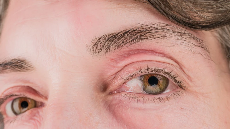 Võng mạc là nơi DHA hiện diện với mật độ rất cao