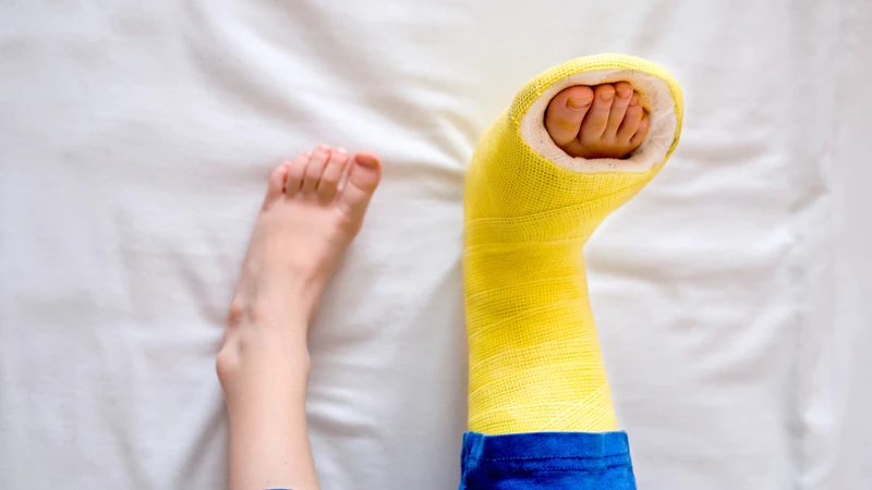 Nắn chỉnh và bó bột được sử dụng phổ biến trong điều trị một số dị tật như bàn chân khoèo bẩm sinh