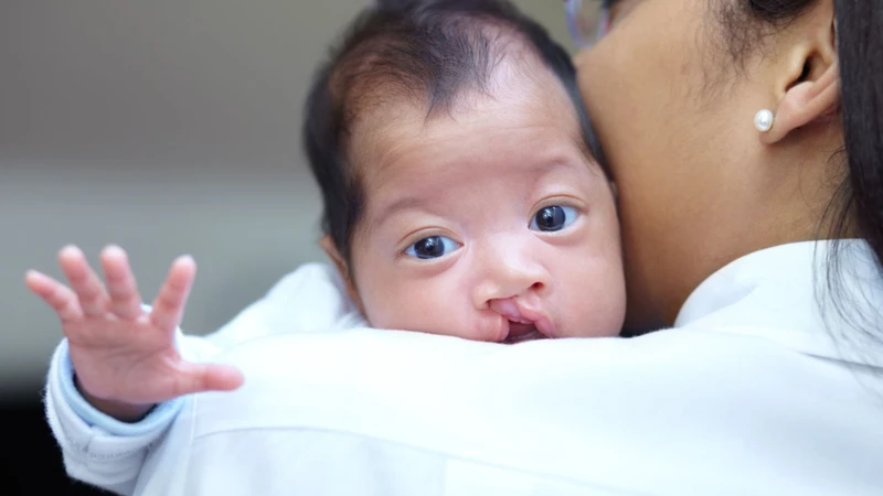 Dị tật thai là gì? Những vấn đề cần biết về dị tật thai 1