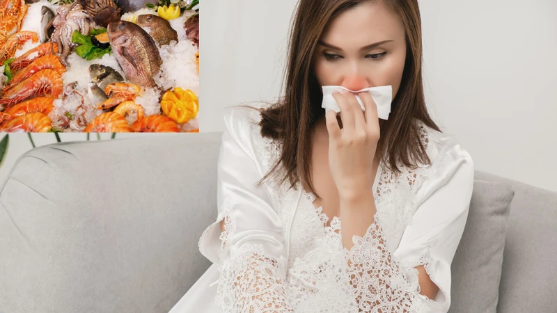 Dị ứng hải sản nên làm gì? Nguyên nhân, mức độ nguy hiểm và cách phòng tránh tái phát 1