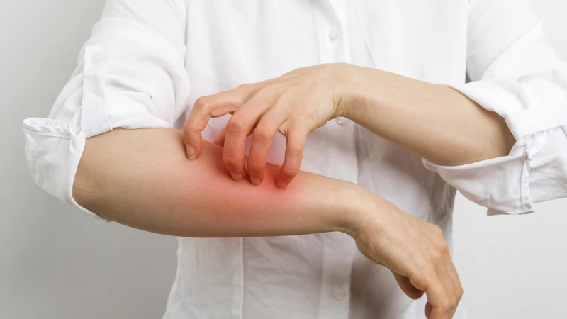 Ghi lại món ăn và triệu chứng giúp hỗ trợ chẩn đoán dị ứng hạt mè