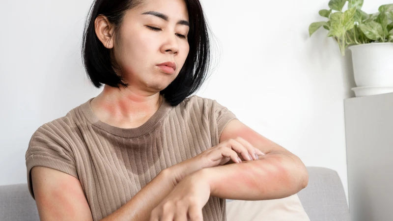 Khó thở và sưng môi có thể là dấu hiệu dị ứng penicillin nghiêm trọng