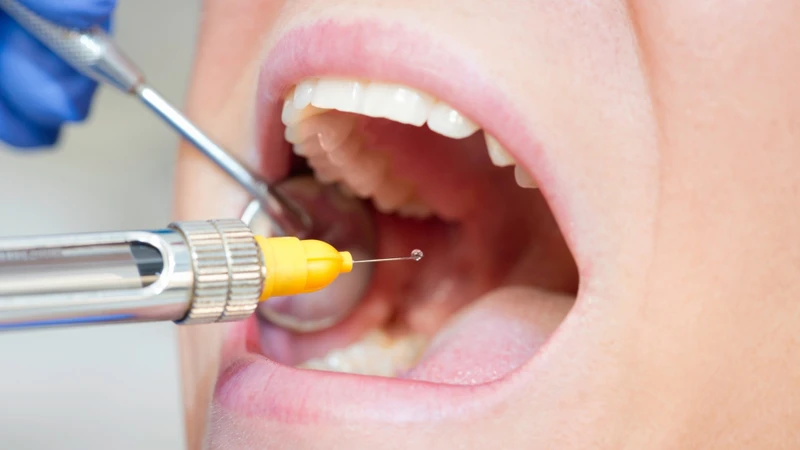 Dị ứng thuốc tê có thể tiến triển nhanh và ảnh hưởng đến nhiều cơ quan nếu không được xử trí kịp thời
