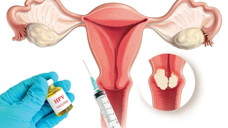 dia-chi-tiem-hpv-o-kien-giang-uy-tin-an-toan (1).png