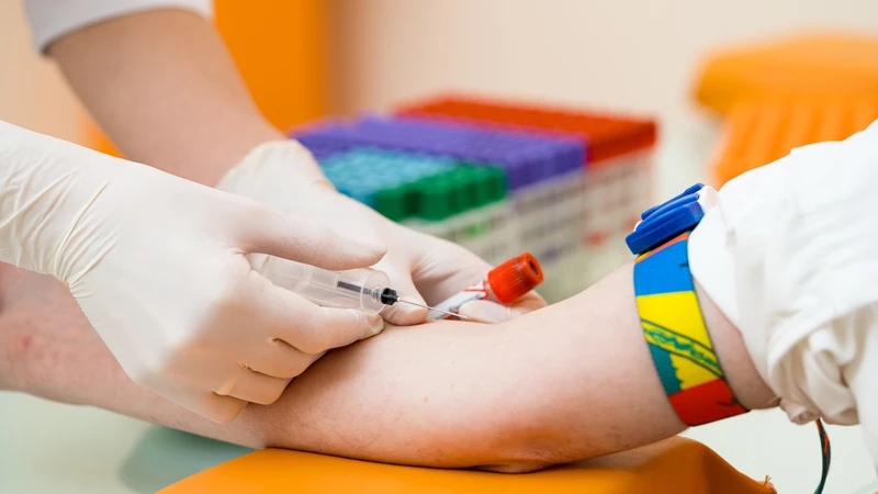 Quy trình lấy máu xét nghiệm Natri diễn ra nhanh chóng và đơn giản
