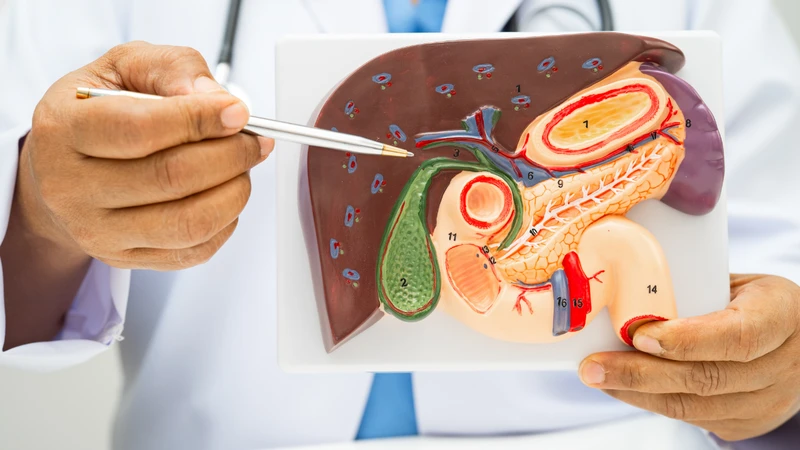 Điều trị polyp túi mật​ cách nào hiệu quả?