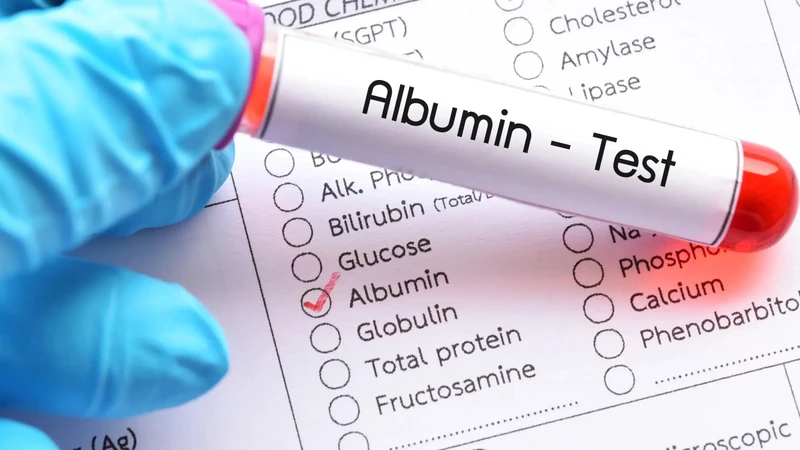 Định lượng Albumin là xét nghiệm được thực hiện nhằm đo nồng độ Albumin trong huyết thanh hoặc huyết tương