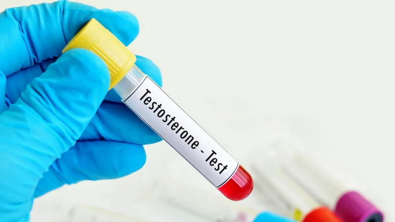 Kết quả testosterone bất thường không nên được sử dụng riêng lẻ để tự chẩn đoán bệnh