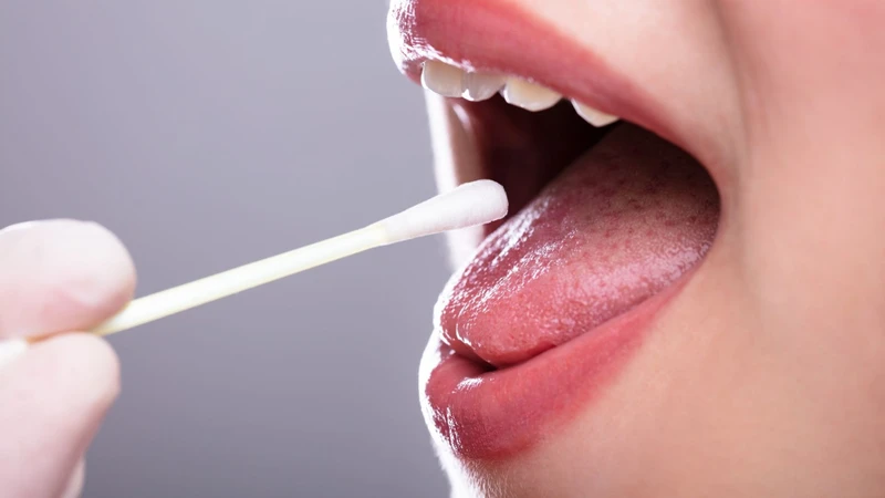 Độ pH nước bọt ảnh hưởng trực tiếp đến sức khỏe răng miệng