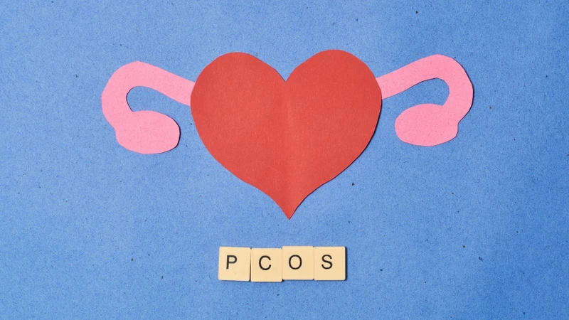 Hội chứng buồng trứng đa nang (PCOS) là một nguyên nhân thường gặp gây tăng androgen ở phụ nữ