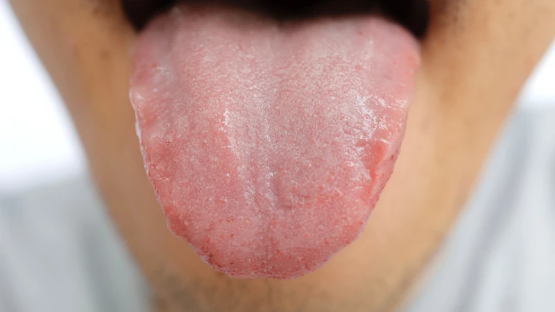 Dưới lưỡi có sợi thịt có thể liên quan cấu trúc niêm mạc