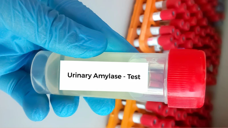 Xét nghiệm amylase giúp đánh giá nồng độ enzyme trong máu hoặc nước tiểu