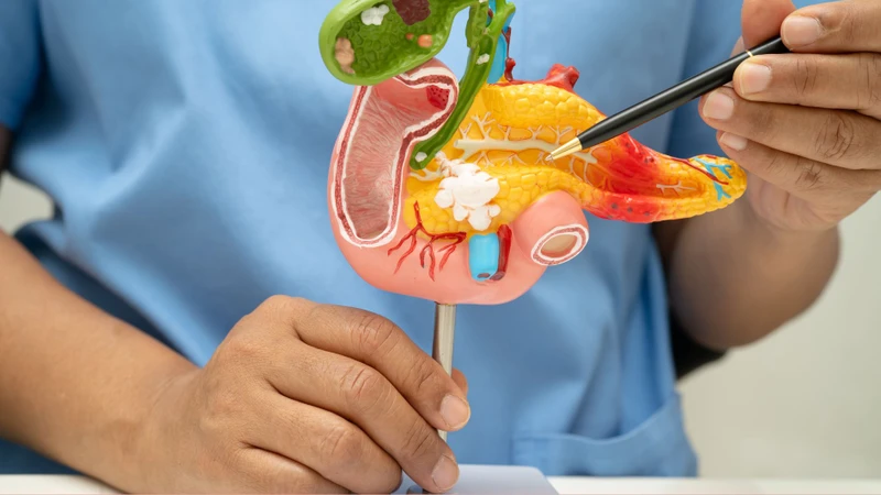 Tắc nghẽn ống tụy có thể làm tăng lipase máu