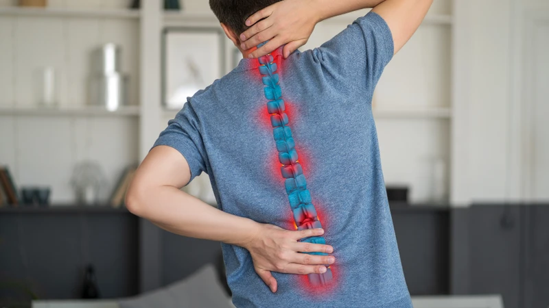 Gai cột sống lưng là kết quả của nhiều yếu tố tác động lâu dài đến cấu trúc cột sống