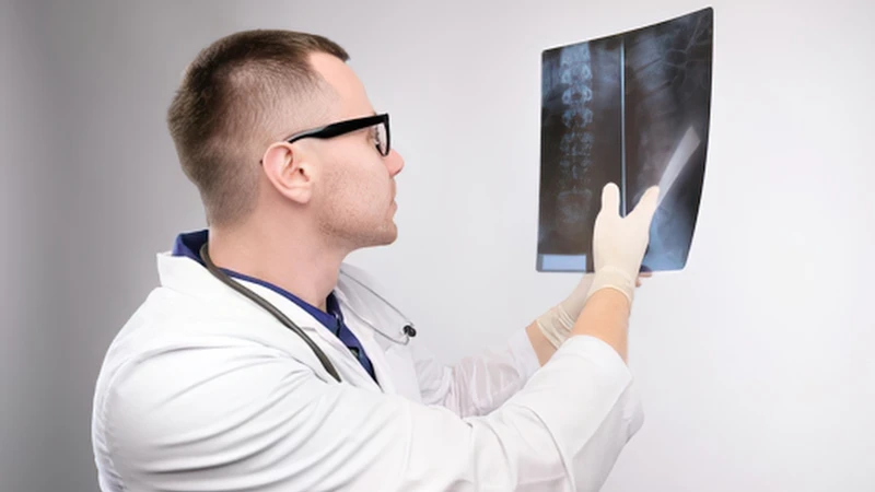 Chẩn đoán hình ảnh giúp xác định chính xác tình trạng cột sống và tủy sống