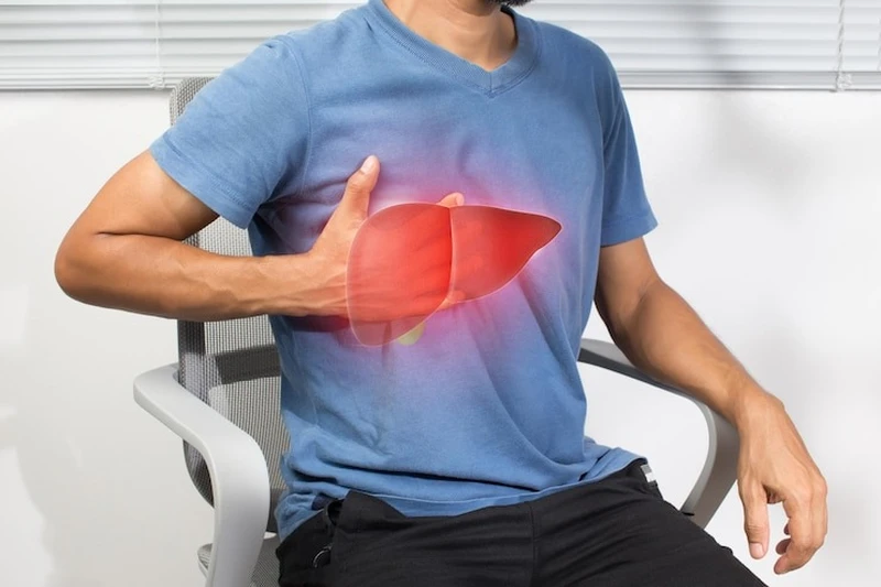 Gan nhiễm mỡ độ 2 là gì? Biến chứng và cách phòng ngừa bệnh 2