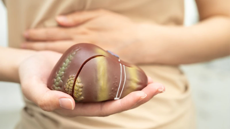 Dấu hiệu nhận biết gan nhiễm mỡ độ 2 có nguy hiểm không thường khó nhận ra ở giai đoạn sớm