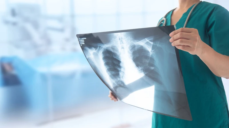 Điều trị bảo tồn là phương pháp điều trị gãy xương vai mà không cần can thiệp phẫu thuật