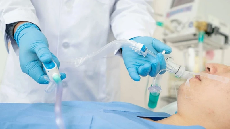 Gây mê nội khí quản là phương pháp gây mê toàn thân được áp dụng phổ biến hiện nay